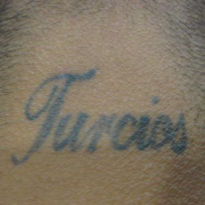 Four square inch professional tattoo before removal