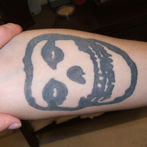 Seven square inch amateur tattoo before removal