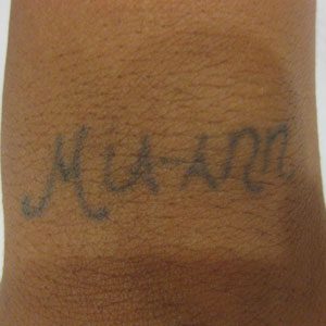 A ten-year-old professional tattoo, one and a half square inches, before laser removal