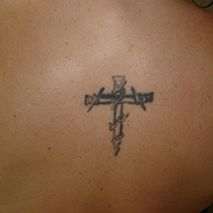 Image of Tattoo Before Laser Tattoo Removal in Detroit | Ink Blasters Metro Detroit Tattoo Removal